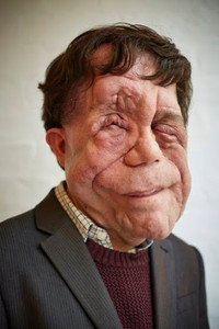 الممثل Adam Pearson